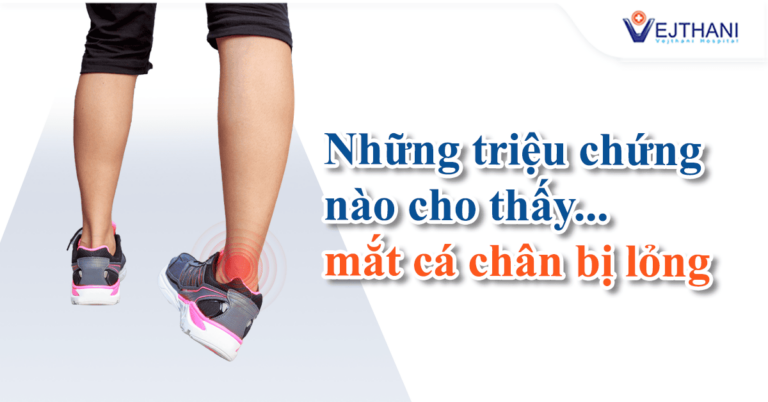 lỏng khớp cổ chân Trung tâm Cơ Xương Khớp, Bệnh viện Vejthani