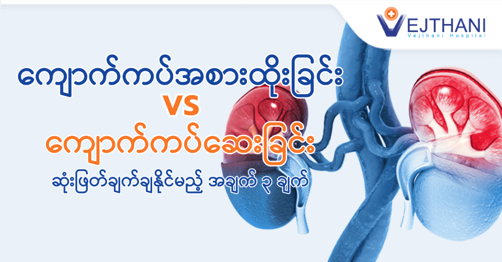 ကျောက်ကပ်အစားထိုးခြင်း နှင့် ကျောက်ကပ်ဆေးခြင်းရွေးချယ်မှုအတွက် ဆုံးဖြတ်ချက်ချနိုင်မည့် အချက် ၃ ချက်