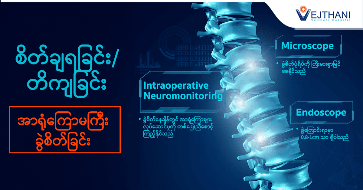 Spinal Fusion Surgery ဖြင့် ခါးနာခြင်းများကို ကုသနိုင်ပြီဖြစ်ပါသည်