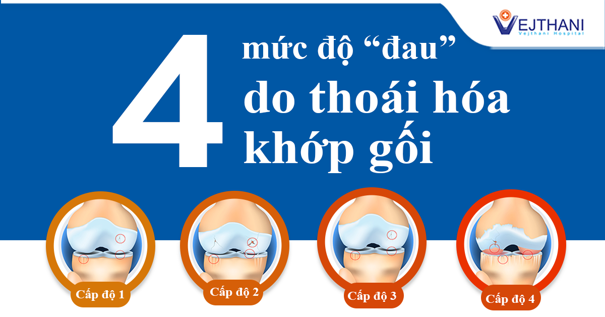 4 Mức độ triệu chứng “đau” do thoái hóa khớp gối