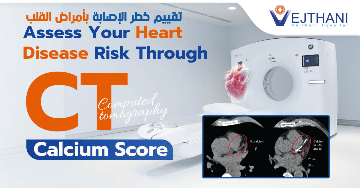 تقييم خطر الإصابة بأمراض القلب من خلال فحص تصوير الكالسيوم بالأشعة المقطعية (CT Calcium Score)