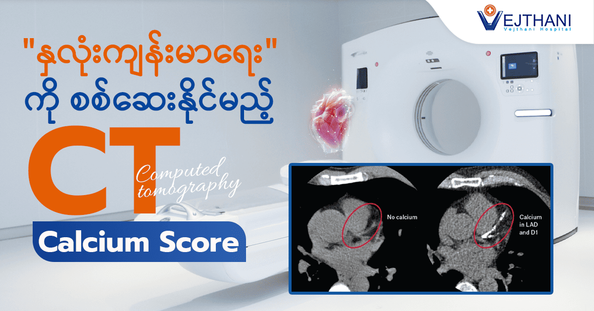  CT Calcium Score Diagnostic Test ဖြင့် သင့်နှလုံးရောဂါအန္တရာယ်ကို အကဲဖြတ်ပါ။