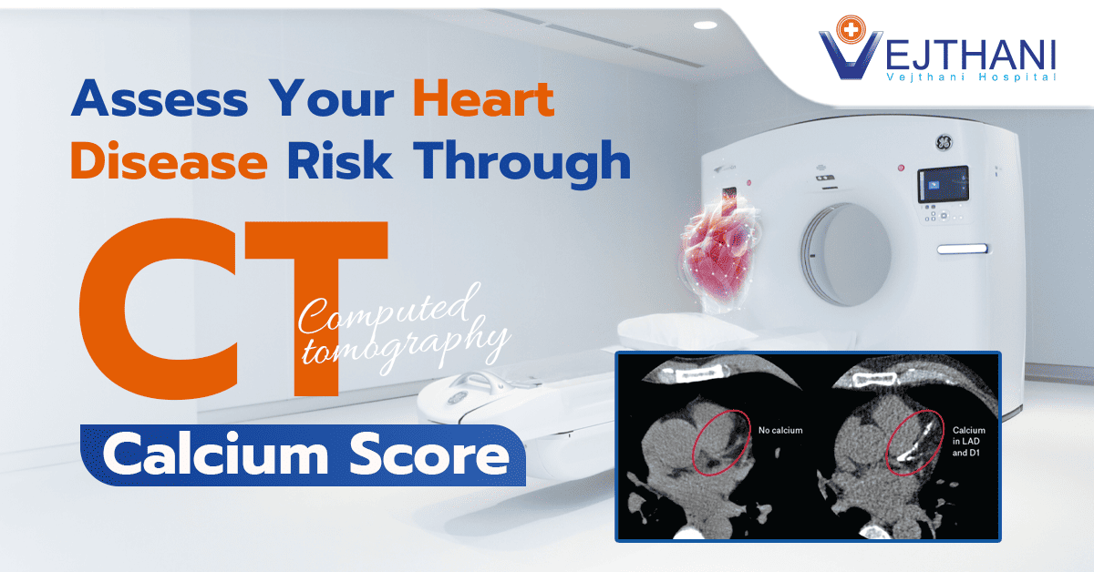 Assess Your Heart Disease Risk through the CT Calcium Score Diagnostic Test