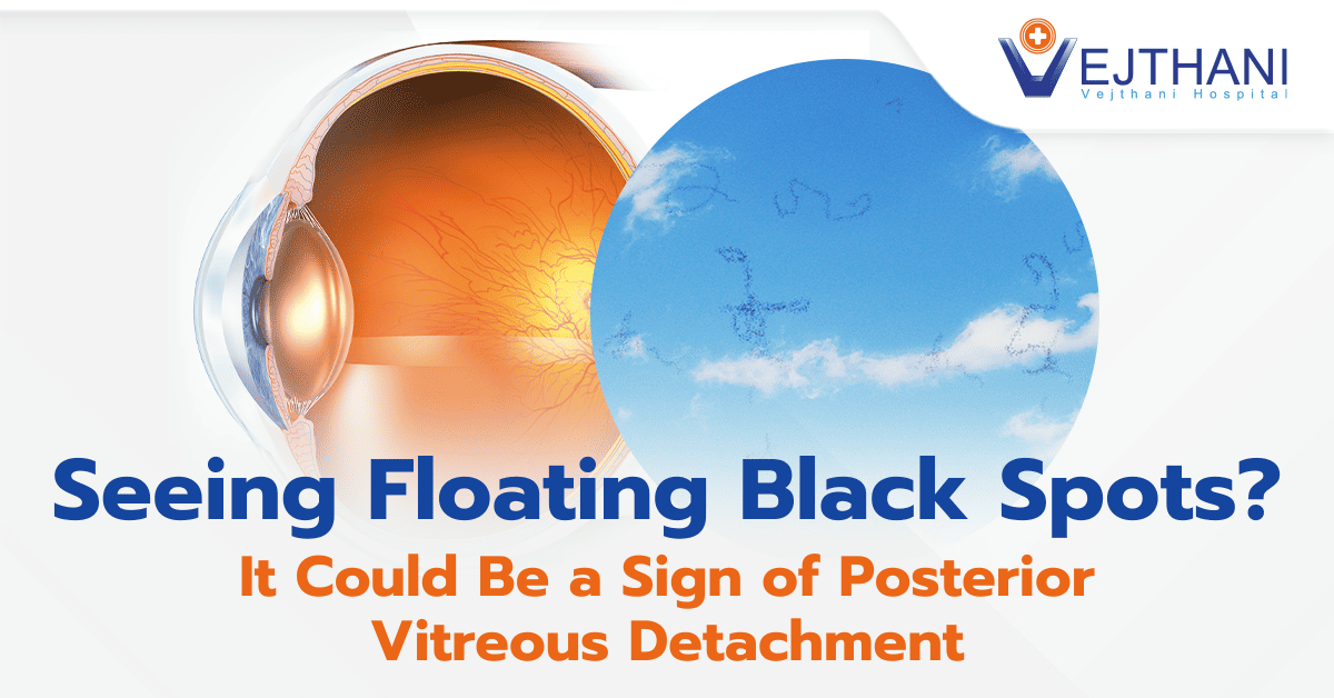 Seeing Floating Black Spots? It Could Be a Sign of Posterior Vitreous Detachment