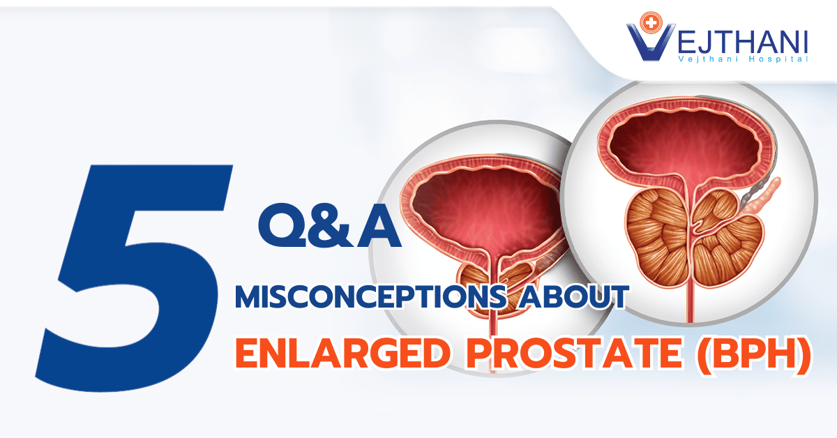 5 Misconceptions About Enlarged Prostate You May Not Know