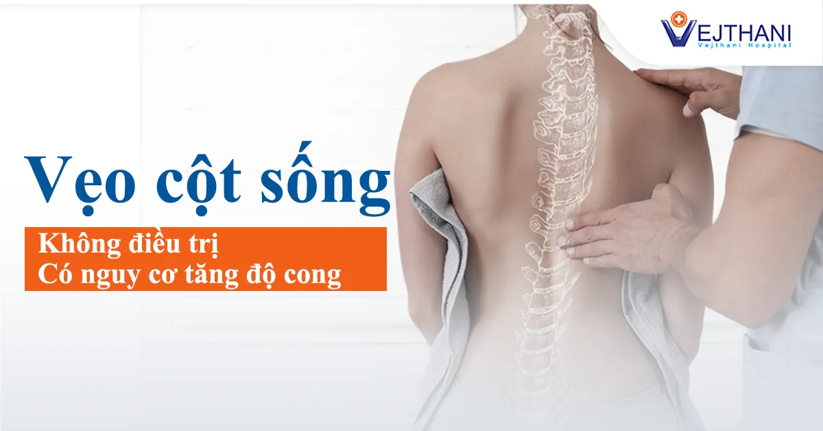 Vẹo cột sống – Không điều trị có nguy cơ tăng độ cong